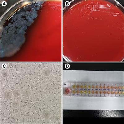 Case Report: Double trouble: a rare case of successfully treated Mycoplasma hominis and Pseudomonas aeruginosa co-infection